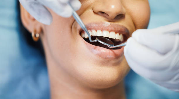 Best Emergency Root Canal Treatment in North Terre Haute, IN