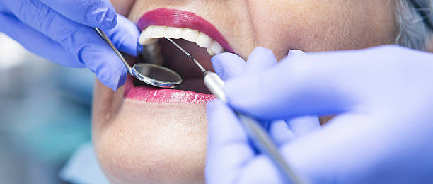 Best Emergency Broken Tooth Repair in North Terre Haute, IN